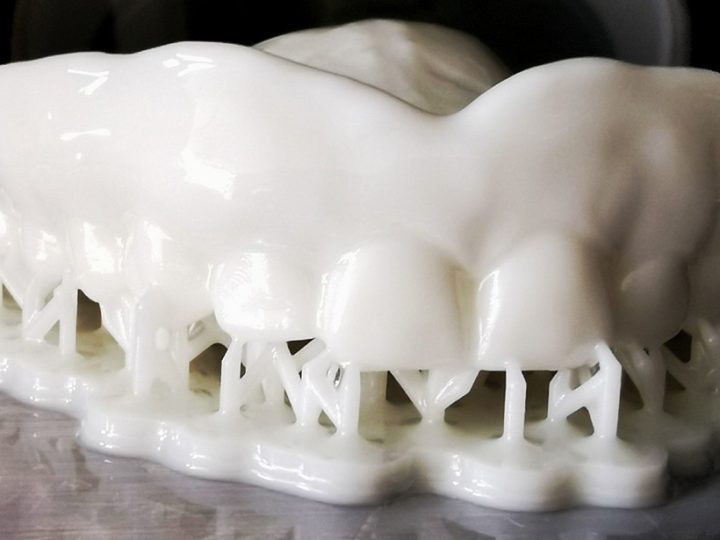 3D tlač v zubnom lekárstve