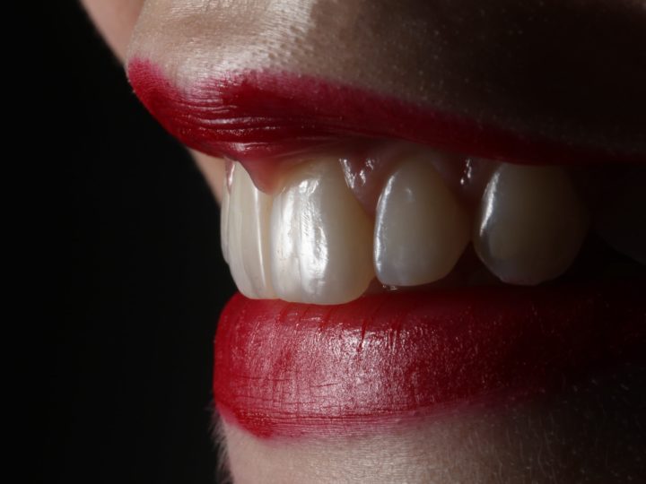 Vplyv bielenia zubov na mikrotvrdosť zubnej skloviny