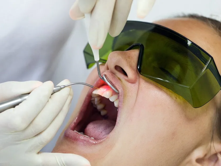 Využitie vysoko-intenzívneho lasera v ortodoncii