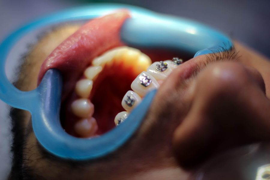 alejourbandj-orthodontics-5764087_1920