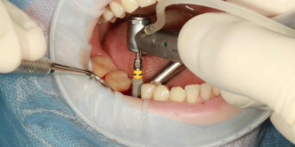 dental-3754769_1280